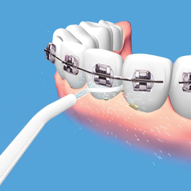 Bán buôn dụng cụ vệ sinh răng miệng Power Floss
