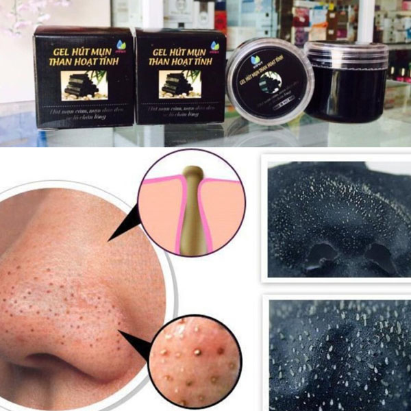 Bán buôn gel hút mụn than hoạt tính 
