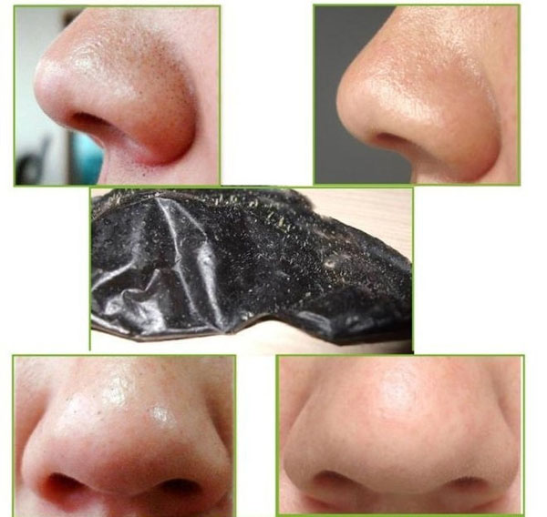 Bán sỉ gel hút mụn than hoạt tính 