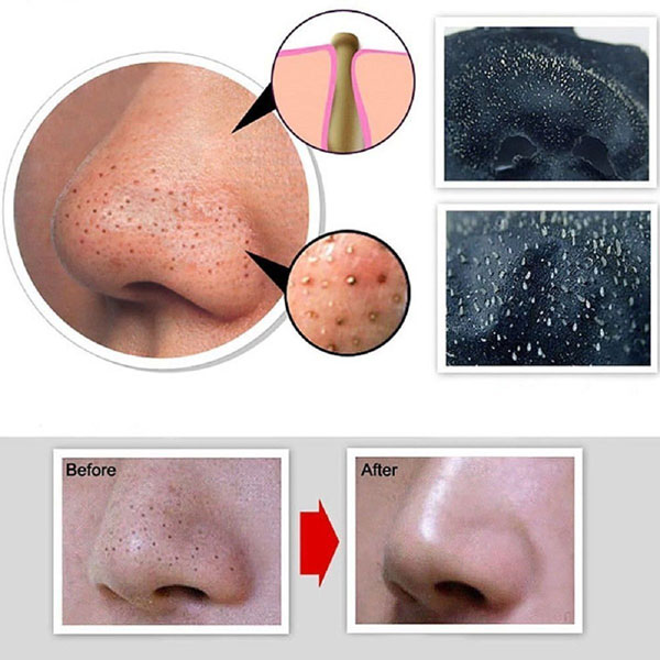 Bán sỉ gel hút mụn than hoạt tính 