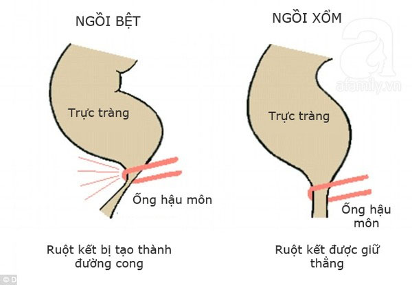 Ghế kê chân toilet , chống táo bón Chefman